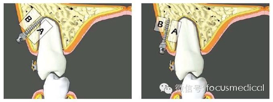QQ圖片20150712111445.png QQ圖片20150712111445.png