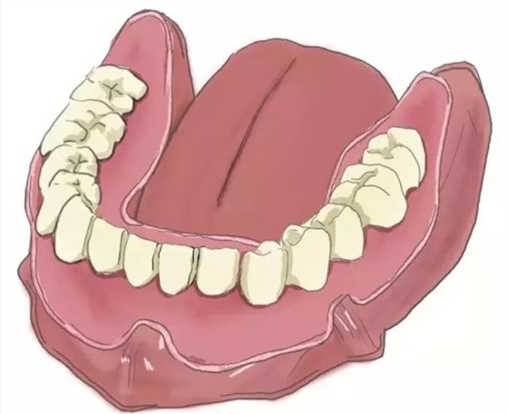 種植【最全的種植牙介紹】 種植【最全的種植牙介紹】