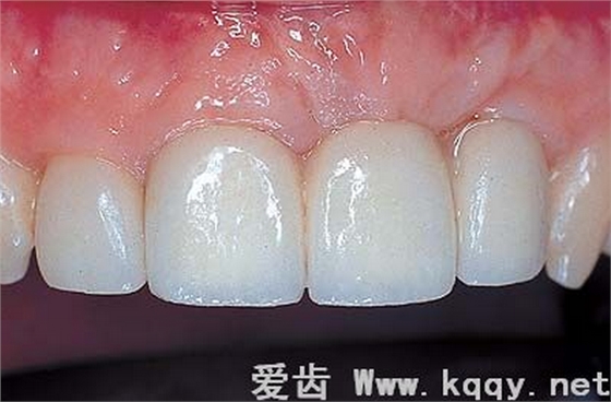 QQ圖片20150818102349.png QQ圖片20150818102349.png