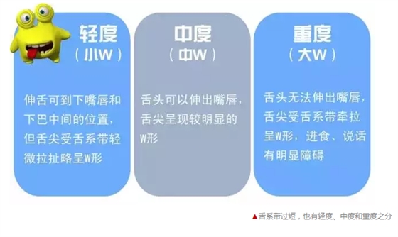 寶寶說話不清楚，是舌系帶惹的禍？