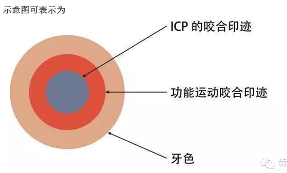 牙科咬合紙的用法