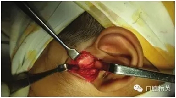 33.webp.jpg 33.webp.jpg