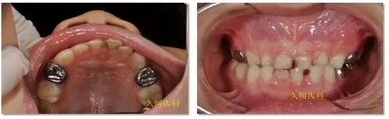 11.webp.jpg 11.webp.jpg