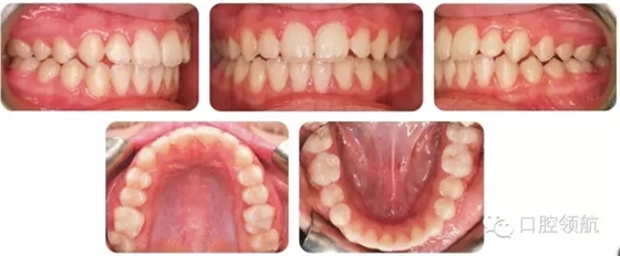 2.webp.jpg 2.webp.jpg