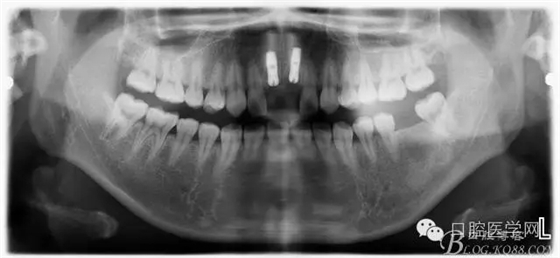 640.webp (3).jpg 640.webp (3).jpg