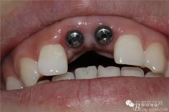 640.webp (4).jpg 640.webp (4).jpg