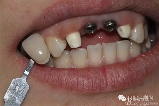 640.webp (9).jpg 640.webp (9).jpg