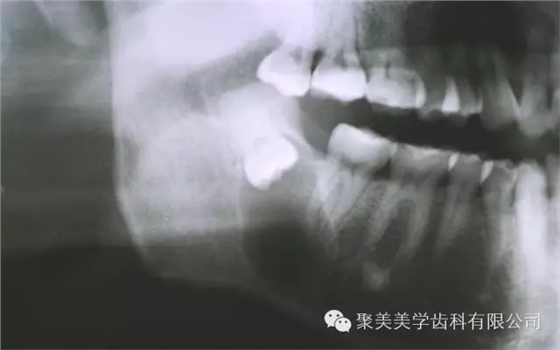 640.webp.jpg 640.webp.jpg