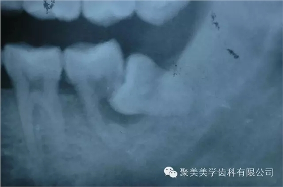 640.webp (2).jpg 640.webp (2).jpg