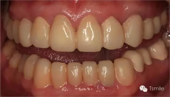 640.webp (2).jpg 640.webp (2).jpg