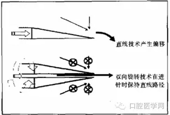 即使是老手也會失手的麻醉----下牙槽、舌、頰一次阻滯麻醉