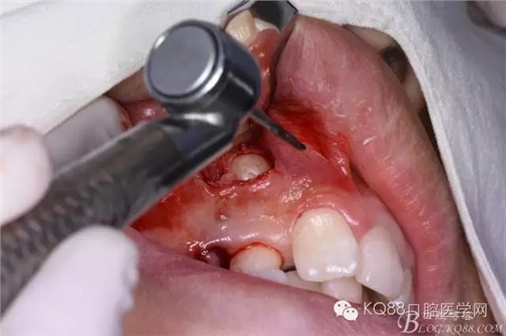 640.webp (7).jpg 640.webp (7).jpg