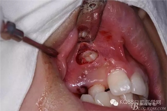 640.webp (9).jpg 640.webp (9).jpg