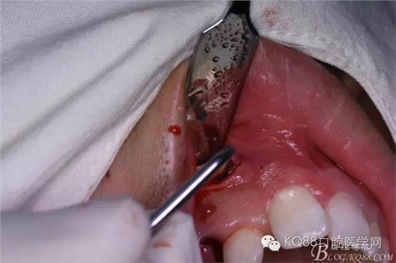 640.webp (11).jpg 640.webp (11).jpg