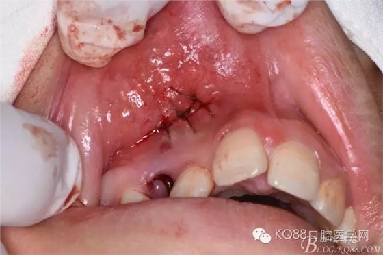 640.webp (16).jpg 640.webp (16).jpg