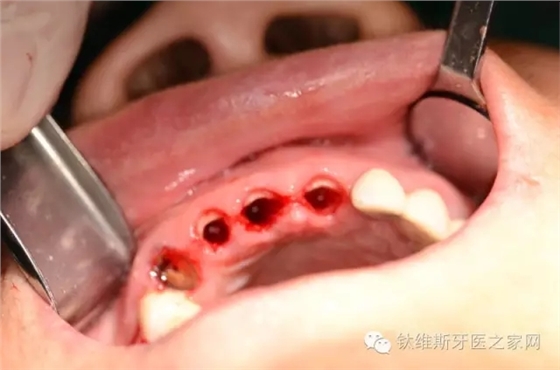 640.webp (3).jpg 640.webp (3).jpg