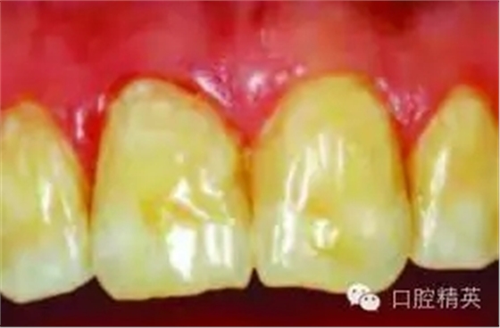 640.webp (1).jpg 640.webp (1).jpg