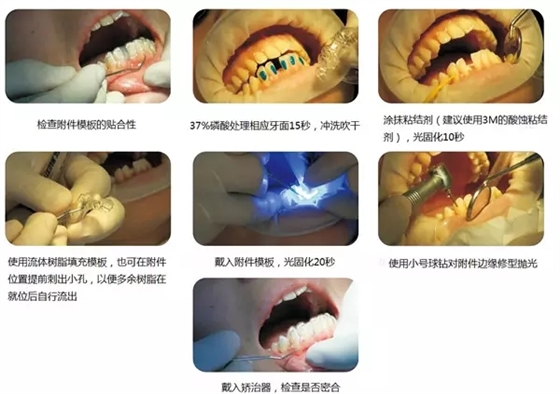 0.webp (2).jpg