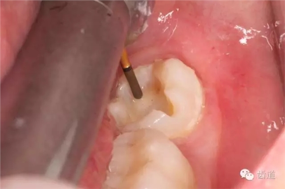 640.webp (38).jpg 640.webp (38).jpg