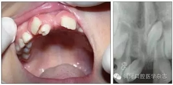 640.webp (4).jpg 640.webp (4).jpg