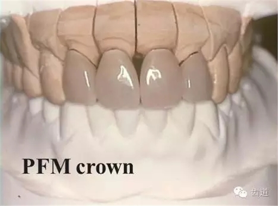 640.webp (3).jpg 640.webp (3).jpg