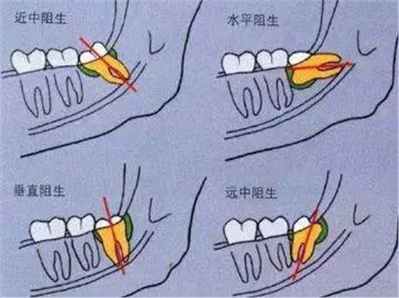 640 (22).jpg 640 (22).jpg