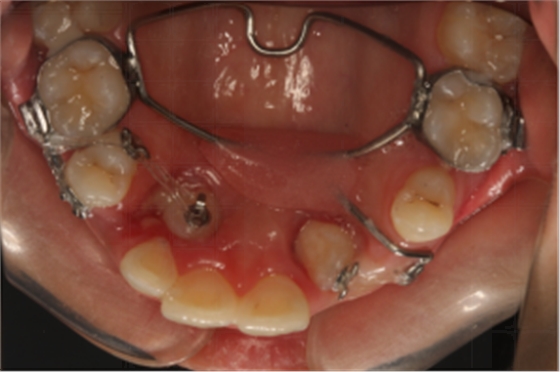 01477648349037_party0.png 01477648349037_party0.png