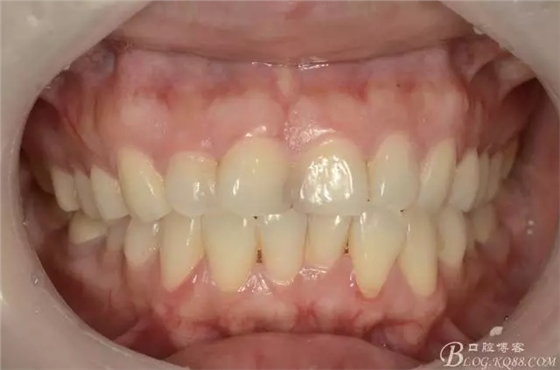 640.webp.jpg 640.webp.jpg