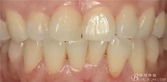 640.webp (11).jpg 640.webp (11).jpg