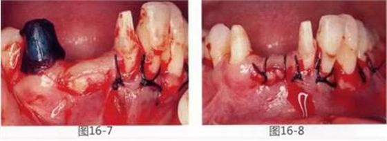 360截圖20170422141952677.jpg 360截圖20170422141952677.jpg