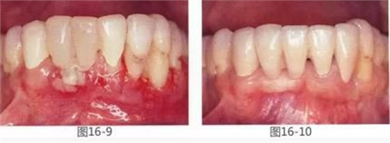 360截圖20170422142001508.jpg 360截圖20170422142001508.jpg