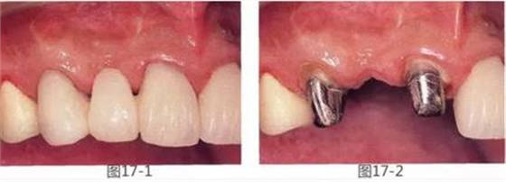 360截圖20170422142010925.jpg 360截圖20170422142010925.jpg