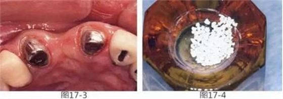 360截圖20170422142020325.jpg 360截圖20170422142020325.jpg