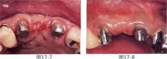 360截圖20170422142045084.jpg 360截圖20170422142045084.jpg