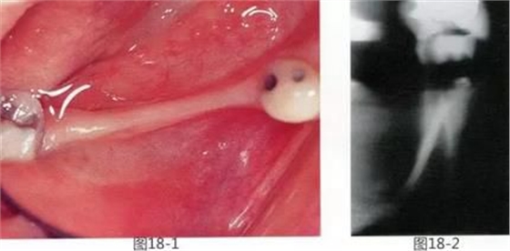 360截圖20170422142104852.jpg 360截圖20170422142104852.jpg