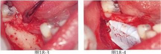 360截圖20170422142114811.jpg 360截圖20170422142114811.jpg