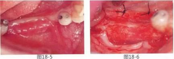 360截圖20170422142122108.jpg 360截圖20170422142122108.jpg