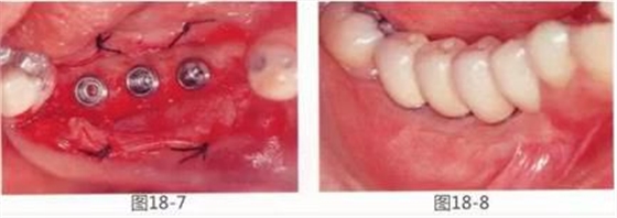 360截圖20170422142129245.jpg 360截圖20170422142129245.jpg