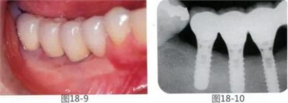 360截圖20170422142137538.jpg 360截圖20170422142137538.jpg