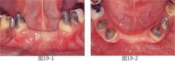 360截圖20170422142144525.jpg 360截圖20170422142144525.jpg