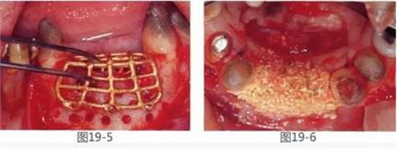 360截圖20170422142203964.jpg 360截圖20170422142203964.jpg