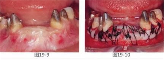 360截圖20170422142221619.jpg 360截圖20170422142221619.jpg