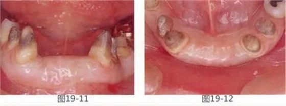 360截圖20170422142229805.jpg 360截圖20170422142229805.jpg