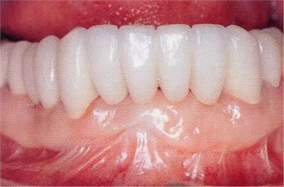 360截圖20170422142238100.jpg 360截圖20170422142238100.jpg