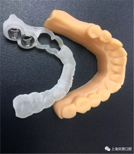 3HT@3IY}}0LK8UPD~X5(V@9.png 3HT@3IY}}0LK8UPD~X5(V@9.png