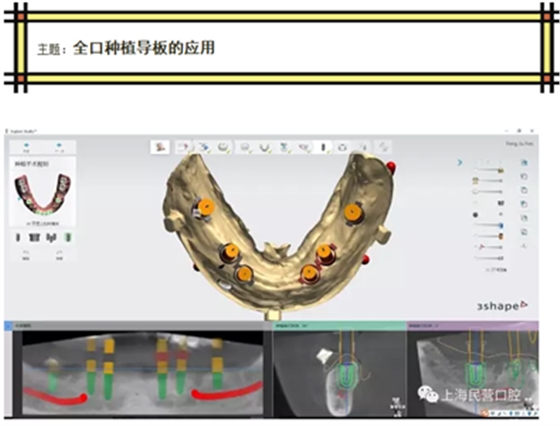CL(7F%HYZ1G_2LB53R8Q(_U.png CL(7F%HYZ1G_2LB53R8Q(_U.png