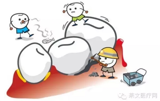 口腔小知識-教你如何甄別牙齦瘤 口腔小知識-教你如何甄別牙齦瘤