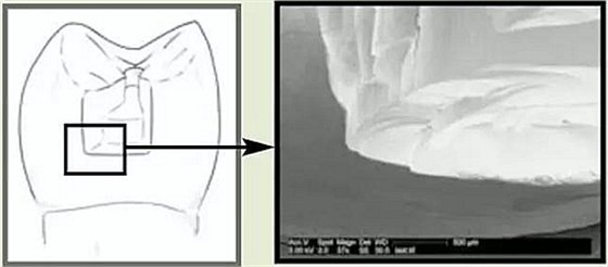 金剛砂和鎢鋼車針，那種更好用？ 