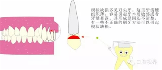 【愛牙科普知識(shí)300問】 “什么是牙齦萎縮？”