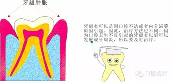 【愛牙科普知識300問】 “什么是牙本質敏感？”